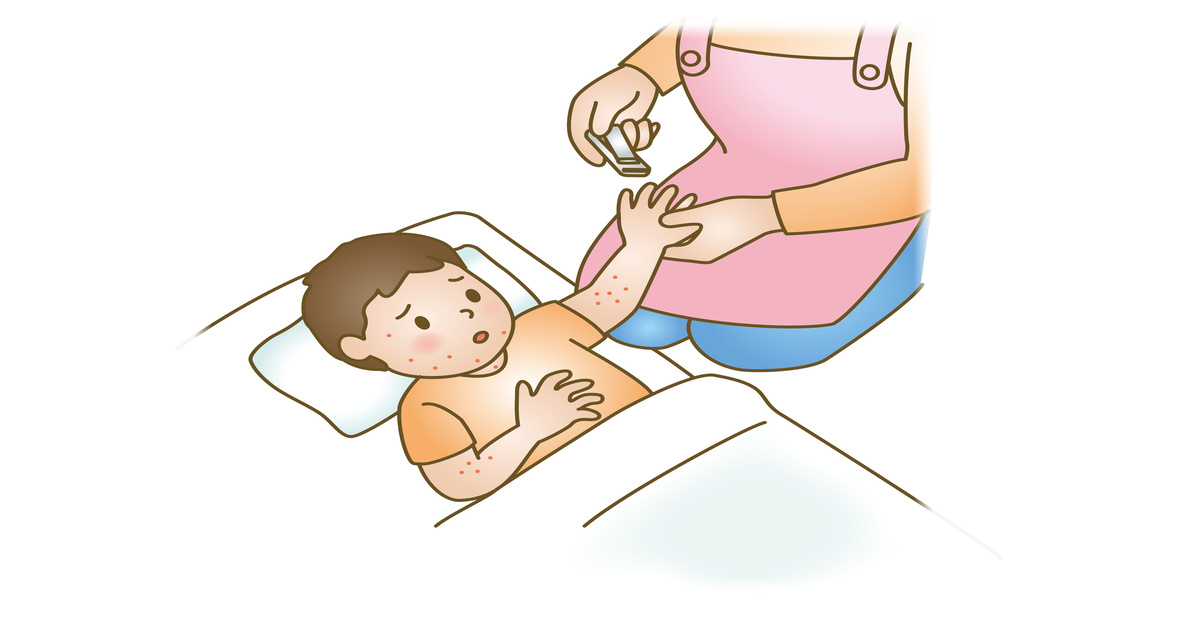 家族の不安を解消する「とびひ（伝染性膿痂疹）」の対処法と感染拡大の予防策