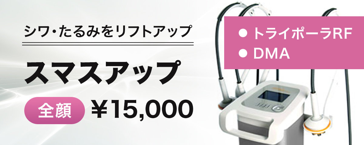 スマスアップ